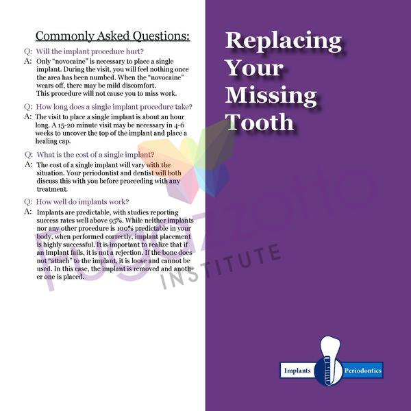 Replacing Your Missing Tooth